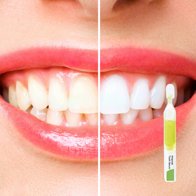 TLOPA Ampullenzahnpasta | Whitening Zahnpasta | Minzgeschmack | Sanfte Formel | 1 Stück | 50% Rabatt