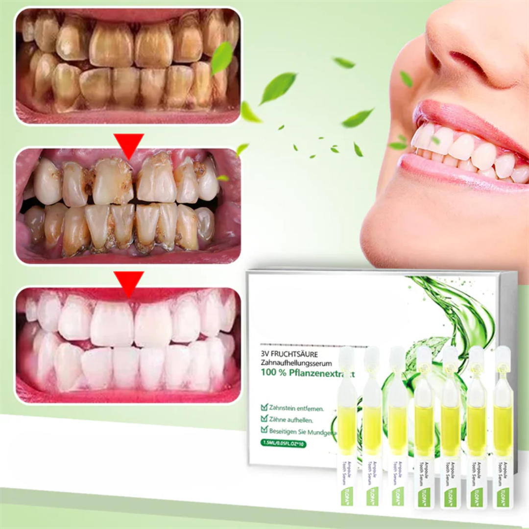 TLOPA Ampullenzahnpasta | Whitening Zahnpasta | Minzgeschmack | Sanfte Formel | 1 Stück | 50% Rabatt