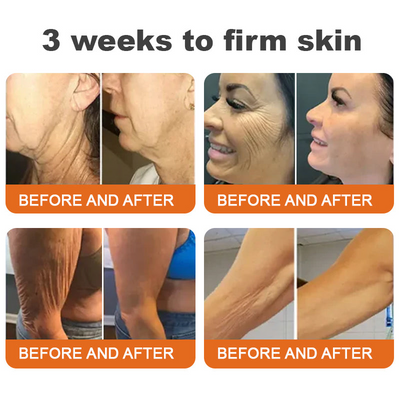 1+1 Gratis | Anti-Aging Serum Stick mit Bienengift | Strafft Haut & Reduziert Falten | Hyaluron & Peptide | Für Gesicht & Körper
