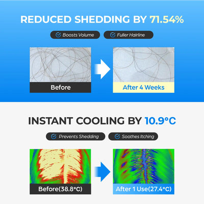 2+2 Gratis | Anti-Haarausfall Serum mit Kopfhautmassager | 2-in-1 Haarwachstums Kur | Kühlt, Stärkt & Fördert Neues Haarwachstum