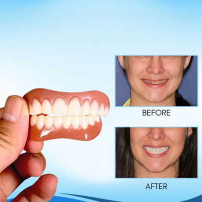 PerfektesLächeln Zahnveneers | Makelloses Lächeln | Wiederverwendbar | 1+1 Gratis | Für Ober- & Unterkiefer
