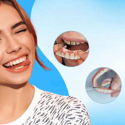PerfektesLächeln Zahnveneers | Makelloses Lächeln | Wiederverwendbar | 1+1 Gratis | Für Ober- & Unterkiefer