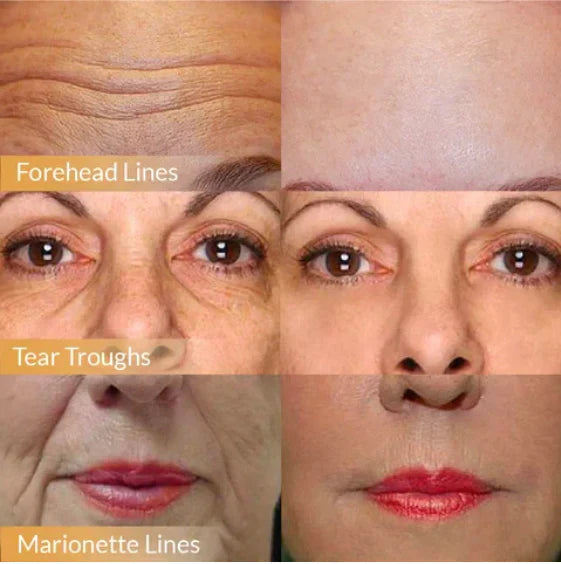 Anti-Aging Gesichtscreme | Japanische Pflege mit Orchideen-Extrakt & Ginseng | Lifting & Feuchtigkeit