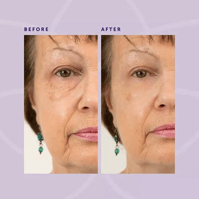 [1+1 FREE] PerfectRepair™ Anti-Aging Faltenradierer Lifting Augencreme