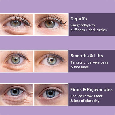 1+1 Gratis | Augenstraffungscreme | Sofort-Effekt gegen Falten, Schwellungen & Augenringe | Straffend & Aufhellend