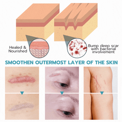 2+2 Gratis | Wiederverwendbare Anti-Falten-Patches | Schlafpads für Gesicht & Stirn | Glättet Linien & Falten über Nacht