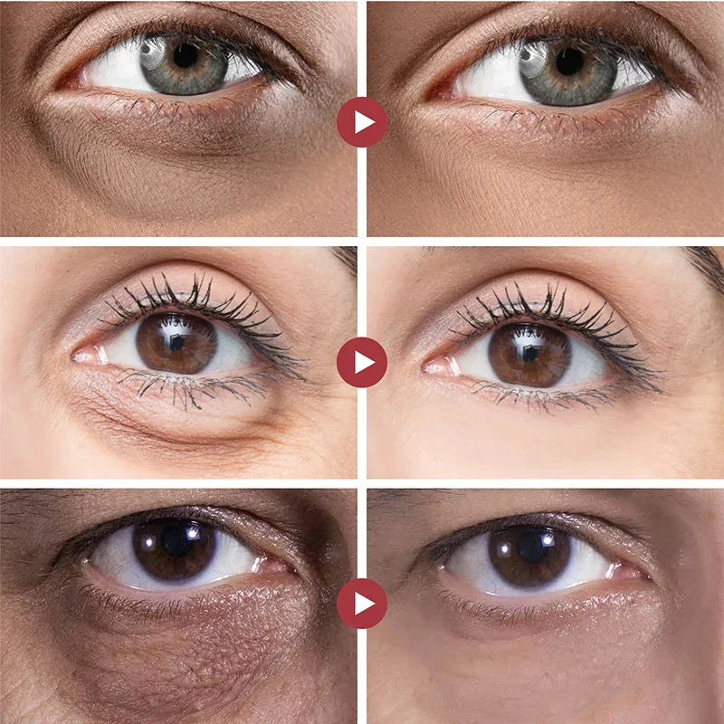 FrischeAugen™ Jugendliche Augenerneuerung