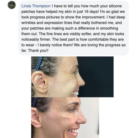 2+2 Gratis | Wiederverwendbare Anti-Falten-Patches | Schlafpads für Gesicht & Stirn | Glättet Linien & Falten über Nacht