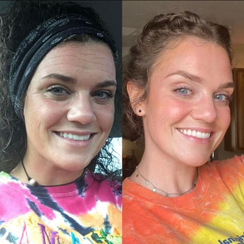 2+2 Gratis | Wiederverwendbare Anti-Falten-Patches | Schlafpads für Gesicht & Stirn | Glättet Linien & Falten über Nacht