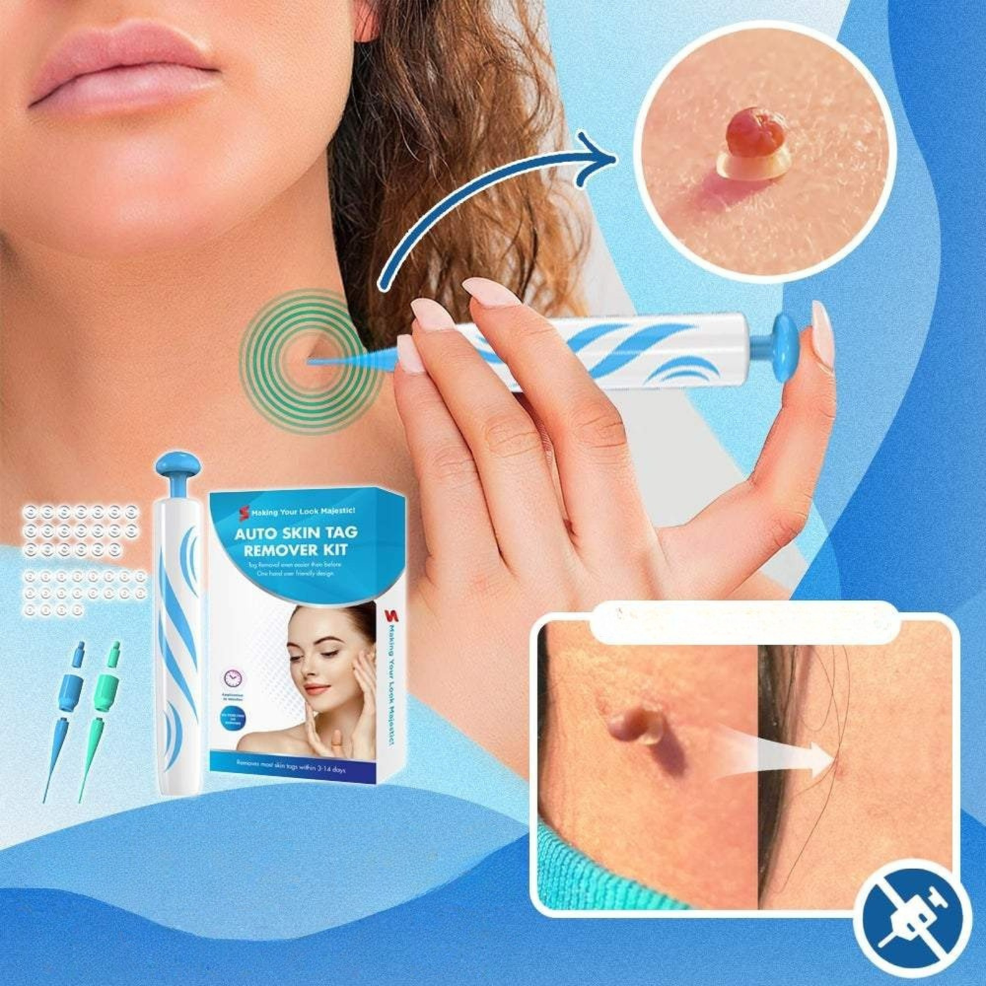 Stielwarzen-Entfernungsset | Schmerzfreie Warzenbehandlung | Schnelle Wirkung & Sanfte Hautpflege | Für Zuhause