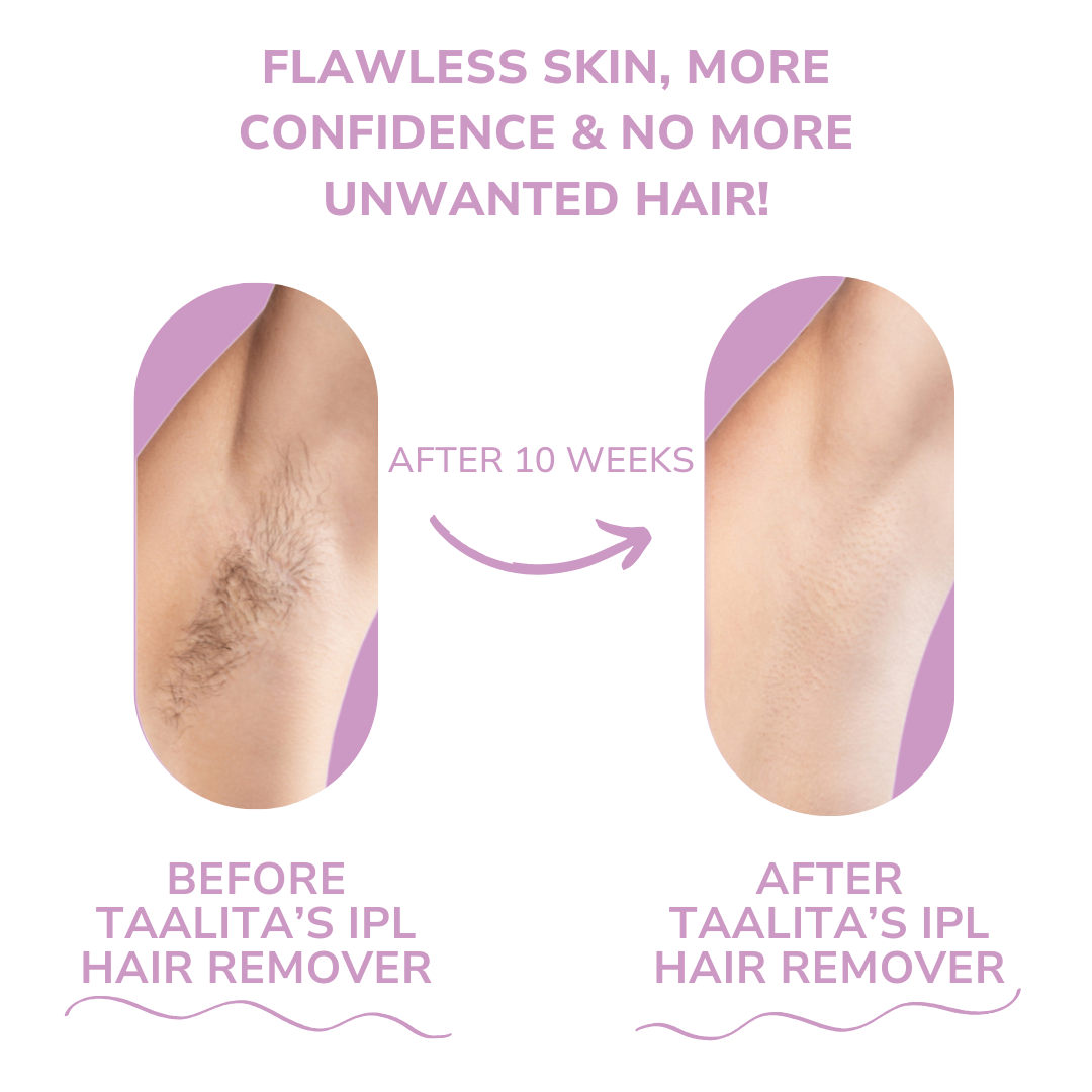 HaareWeg™ Haarfreies Leben in nur wenigen Minuten