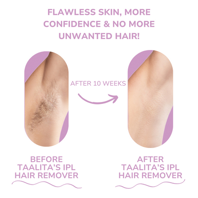 HaareWeg™ Haarfreies Leben in nur wenigen Minuten