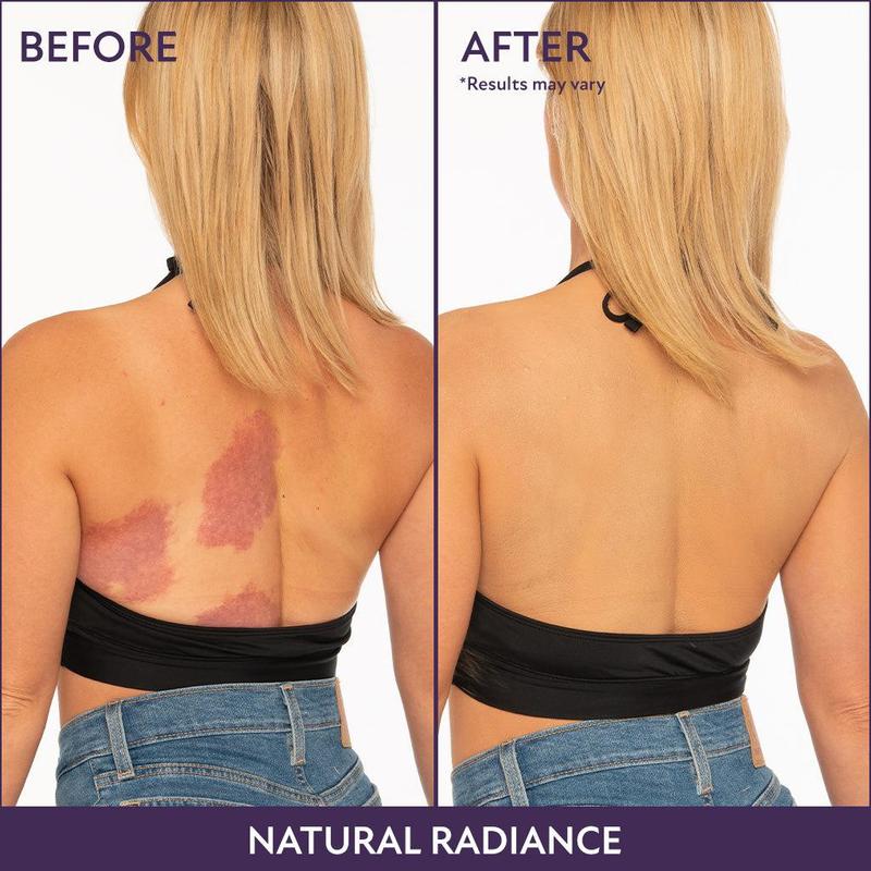 Körper-Perfektionierer | Kaschiert Narben, Venen & Flecken | Wasserfest & 24h Halt