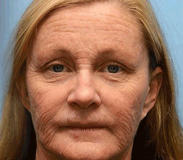 2+2 Gratis | Anti-Falten Creme | Straffende Gesichtscreme mit Feuchtigkeit & Glow Effekt | Glättet Falten & Verleiht Jugendliche Haut