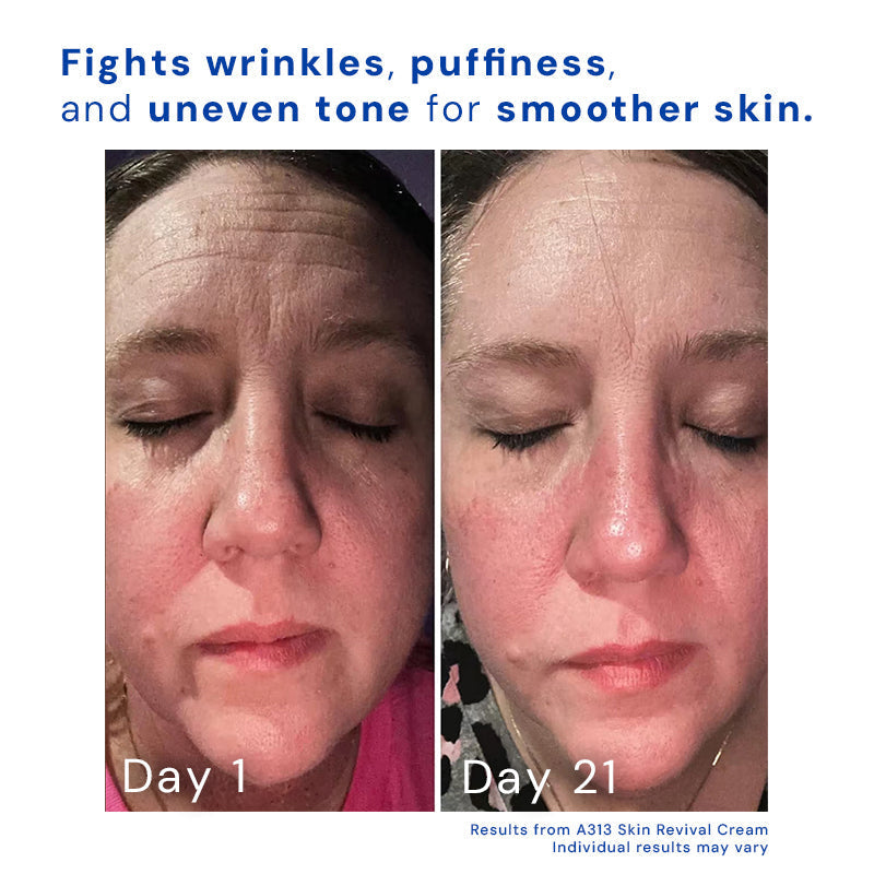 Retinol Gesichtscreme | Vitamin A Anti-Aging Nachtcreme | Glättet Falten & Beugt Akne vor | Dermatologisch getestet